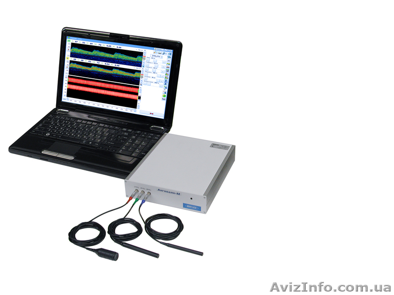 Кардиограф, допплер, энцефалограф, миограф, реограф Черновцы - <ro>Изображение</ro><ru>Изображение</ru> #1, <ru>Объявление</ru> #1048475